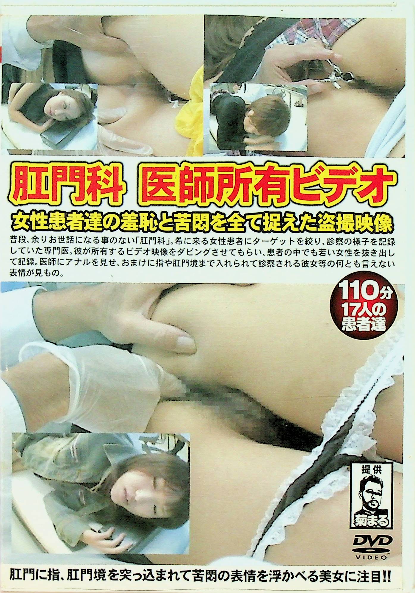 肛門科　医師所有ビデオ